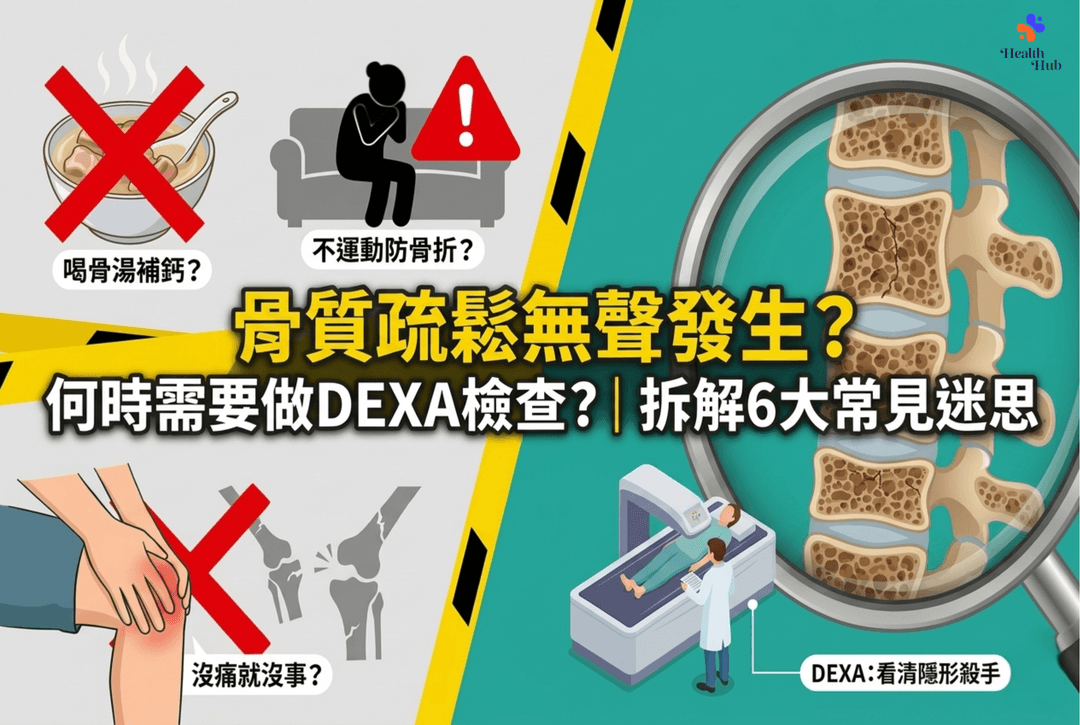 骨質疏鬆無聲發生？何時需要做DEXA檢查？｜拆解6大常見迷思