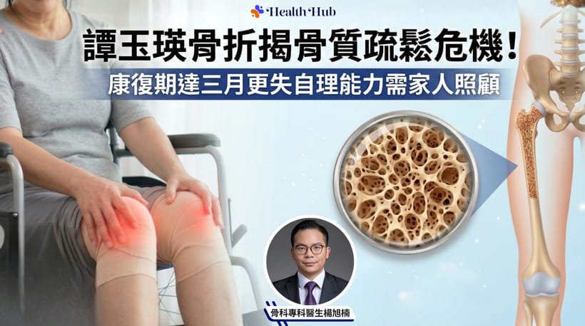 骨質疏鬆症
