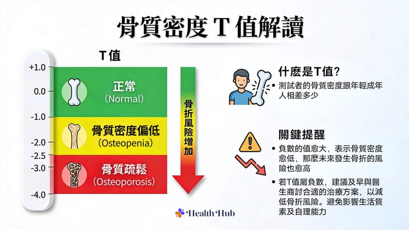 骨質疏鬆症