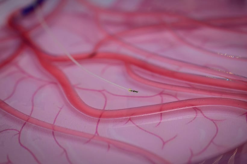 中風、心血管疾病