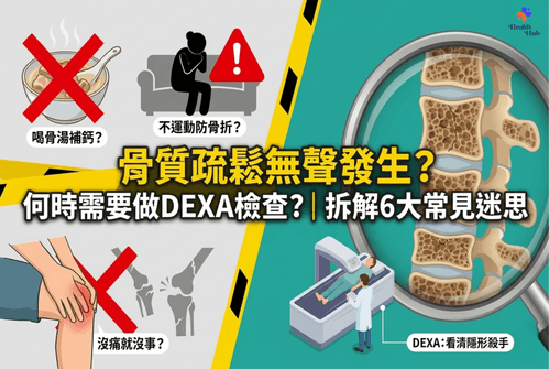 骨質疏鬆無聲發生?何時需要做DEXA檢查?|拆解6大常見迷思